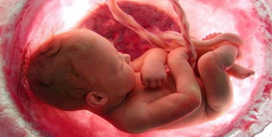 «سقط جنین» در پی آلودگی هوا