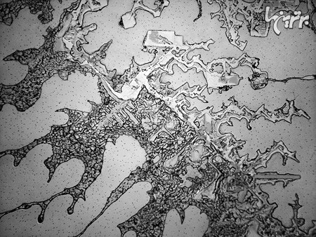 قطرات اشک را زیر میکروسکوپ ببینید