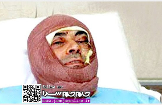 عکس پزشک قربانی اسیدپاشی پس از حادثه