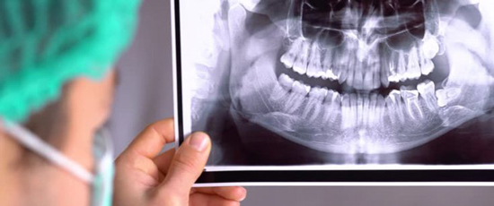 رادیوگرافی دندان و انواع آن