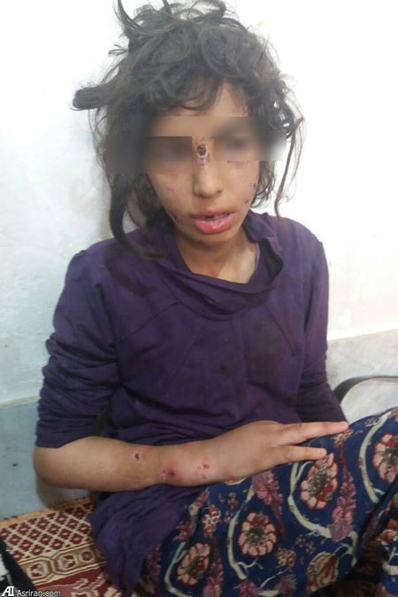 تصاویر تلخ از نجات کودکان آزار دیده در ماهشهر