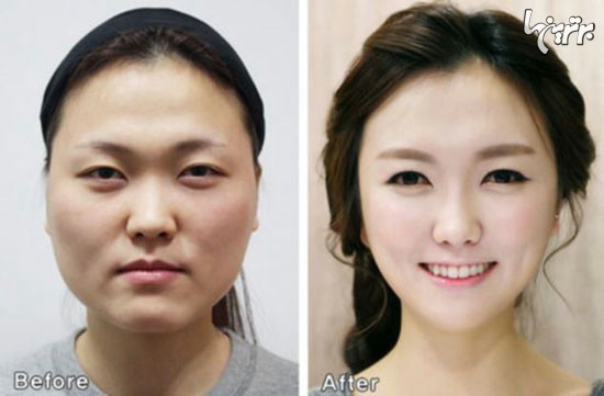 دردسر هویتی جراحی زیبایی دختران کره‌ای!