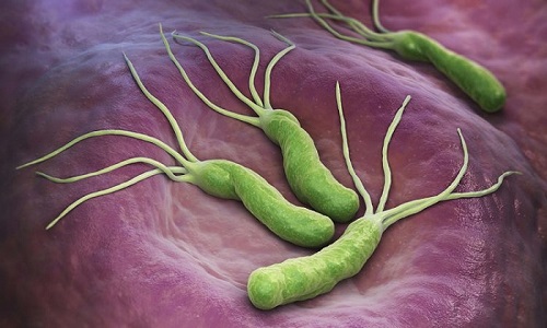 عفونت میکروبی معده؛ از علائم تا پیشگیری