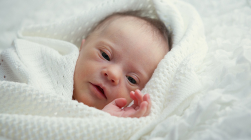 تولد نوزاد با سندرم داون؛ مهمترین دلایل