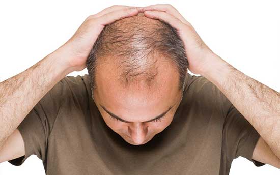 پیشگیری از ریزش مو‌ با ۷ خوراکی موثر