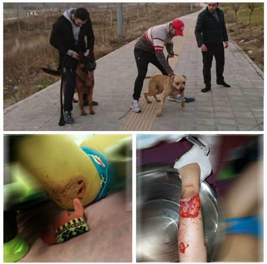 حمله ۲ سگ به یک دختر بچه در لواسان