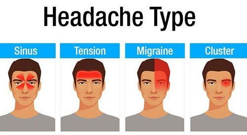 4 سردرد خطرناک کدامند؟