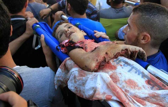 فاجعه در «غزه» +عکس (18+)