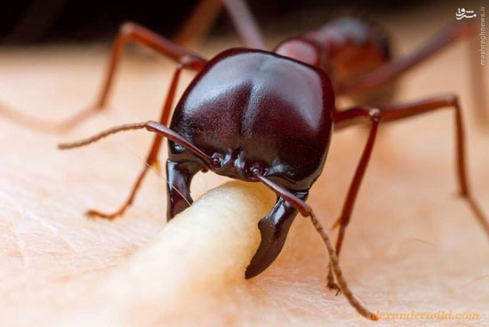 عکس: لحظه گاز گرفتن مورچه از انسان