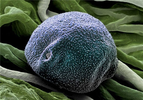 اندام شگفت‌انگیز موجودات میکروسکوپی