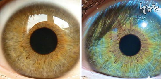 چیز‌های عجیبی که رنگ چشمتان را عوض می‌کنند!