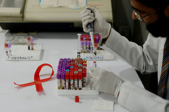 درمان «HIV» نزدیک است