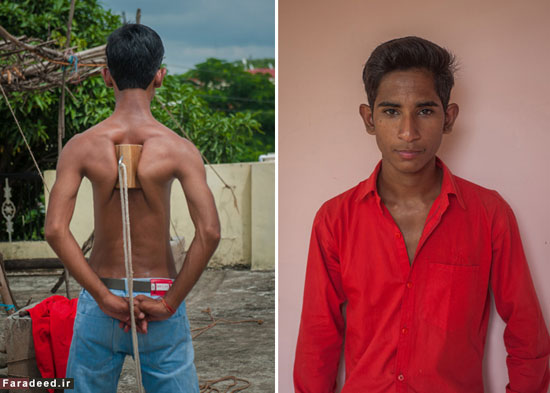کتف‌های باورنکردنی نوجوان هندی
