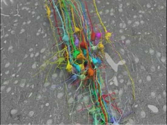 تصاویر نانو از درون مغز