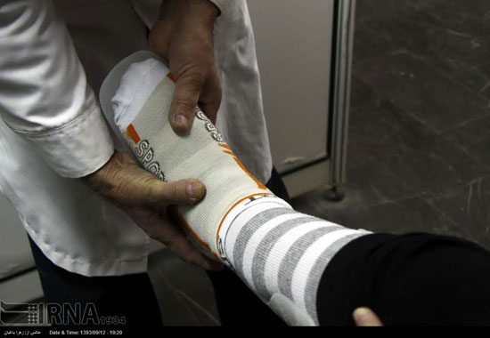 عکس: کارگاه تولید دست و پای مصنوعی