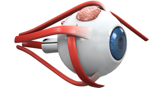 تشخیص و درمان انحراف چشم در کودکان