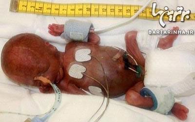 کوچک ترین نوزاد متولد شده تاریخ +عکس