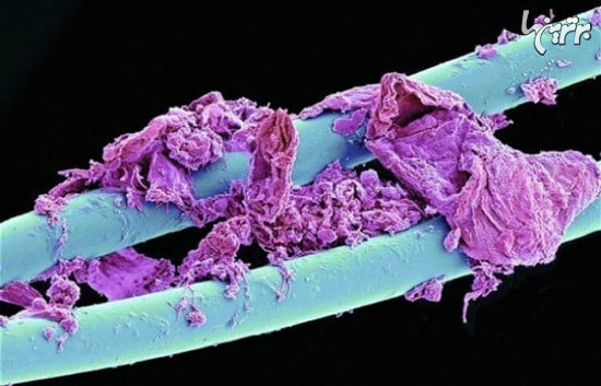 تصاویر جالب و دیدنی اجسام زیر میکروسکوپ