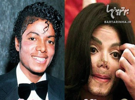 5 چهره‌ای که بعد از جراحی زیبایی زشت‌تر شدند