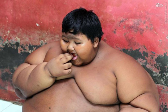 چاق‌ترین پسر دنیا +عکس