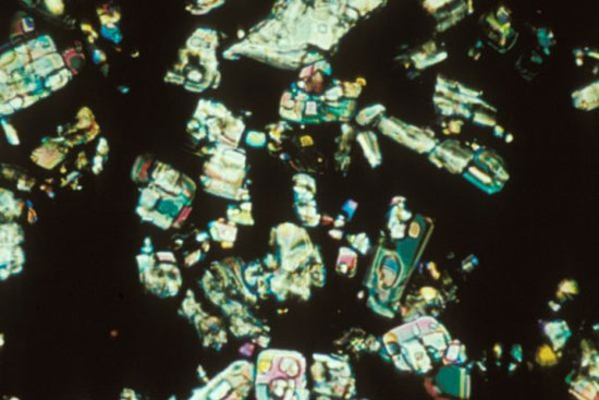 تصاویر ویتامین‌ها در زیر میکروسکوپ