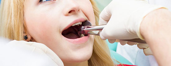کشیدن دندان عقل موجب مرگ می‌شود؟