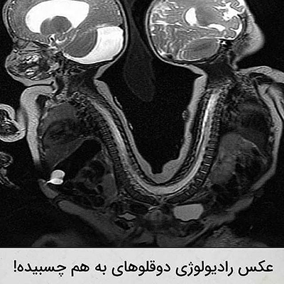 عکس‌هایی که تابه‌حال ندیده‌اید!