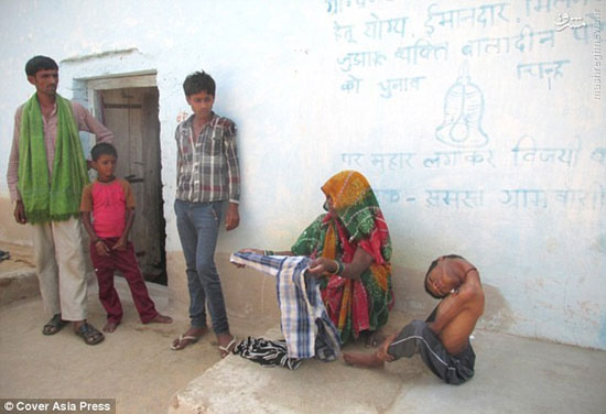 عکس: پسر 12 ساله هندی با سرِ برعکس