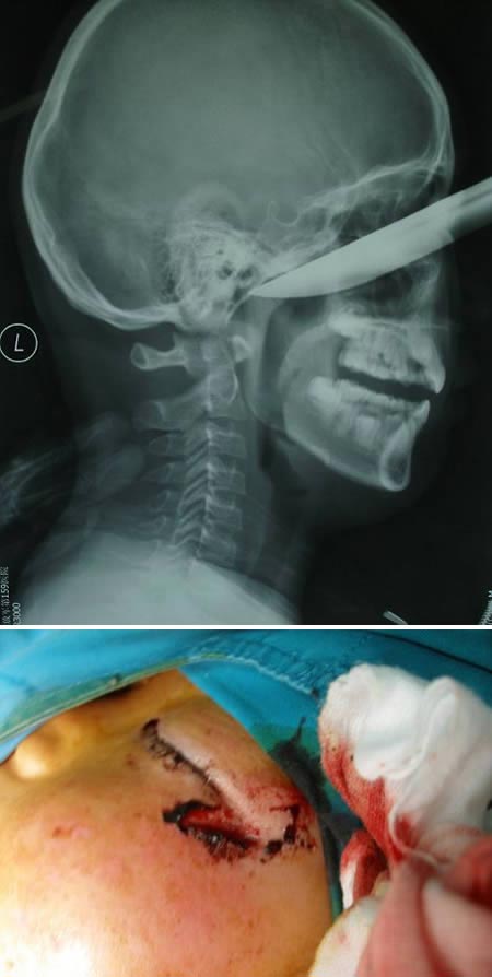 عجیب ترین عکس های رادیولوژی پزشکی