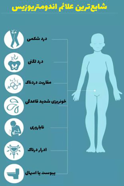 اندومتریوز؛ هر آنچه که باید درباره آن بدانید