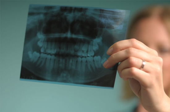 رادیوگرافی دندان و انواع آن