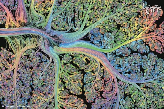 تصاویر جذاب و دیدنی از اسکن های مغزی پیشرفته