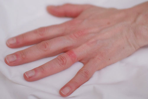 10 نکته درباره حساسیت پوستی به زیورآلات