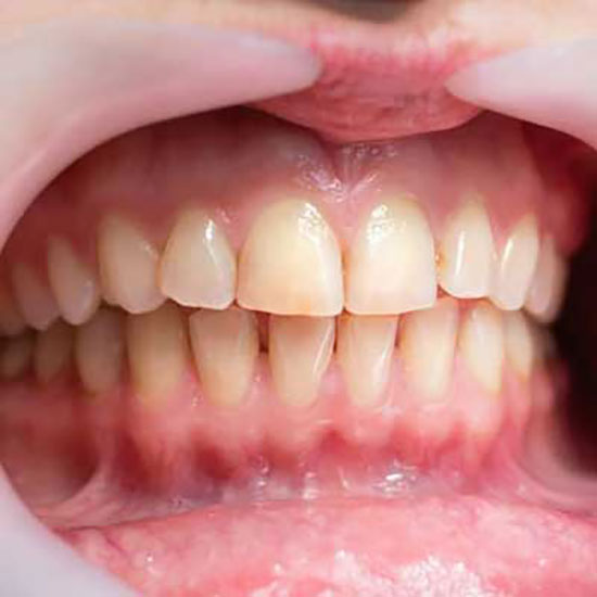 اطلاعات علمی جدید و مفید درباره جراحی لثه و کاشت دندان