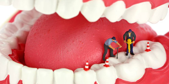 5 سوالی که درباره عصب کشی دندان می‌پرسند