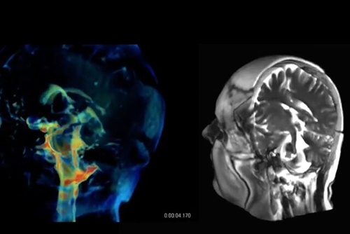 فناوری جدیدی برای تصویربرداری ۳بعدی از مغز