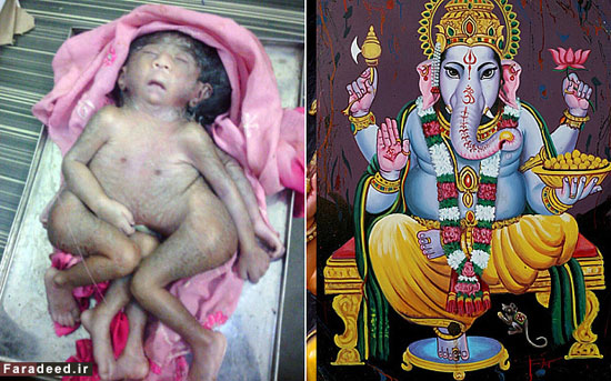 پرستش کودک ناقص الخلقه هندی (18+)