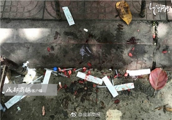 عمل غیرقانونی از بین بردن صدا سگ‌ها در خیابان‌های چین